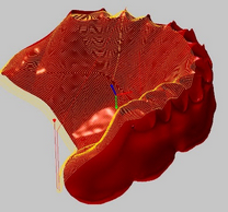 Interior area, occlusal side