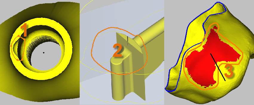 user defined areas