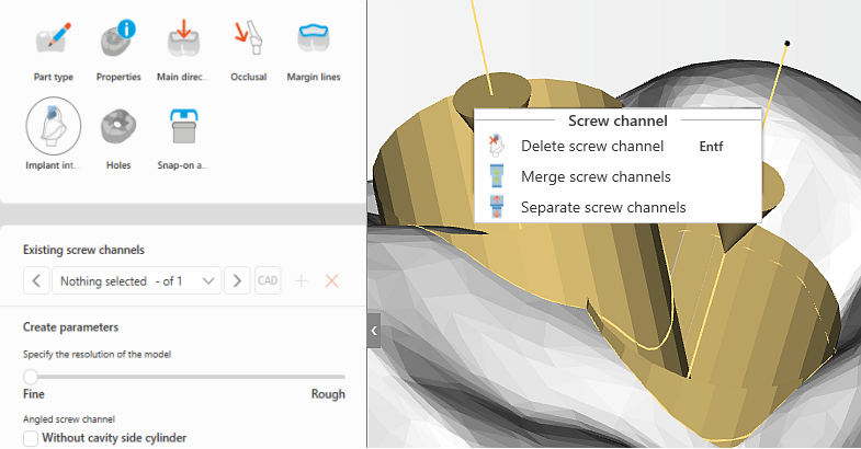 detect angulated screwchannel 6