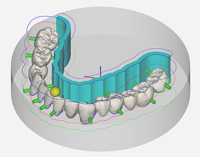 workflow_set sinter frame-pic1-9.1