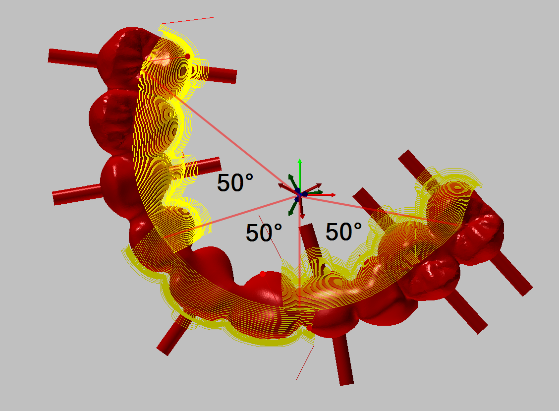 segmented-machining-segment-angle