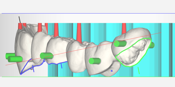 set-and-check-frame-9-9.1