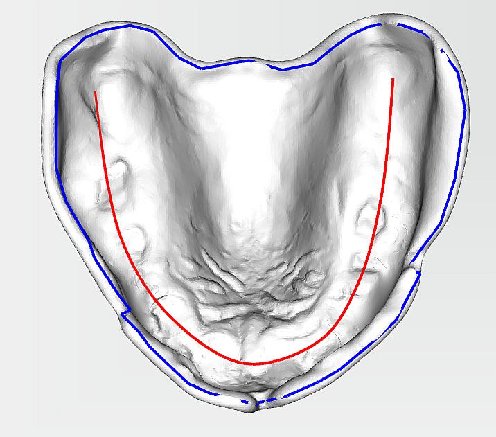 upper-jaw-alveola-ridge