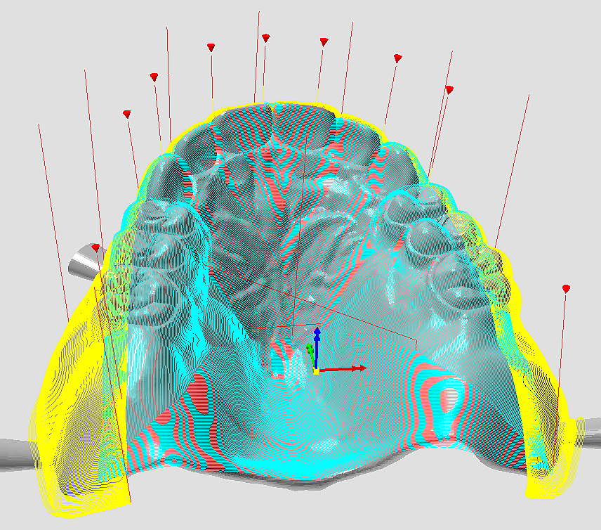 upper-jaw-arch-curve-milling