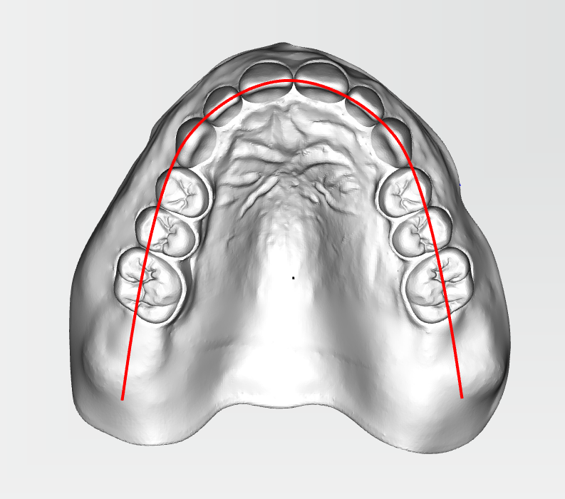 upper-jaw-arch-curve